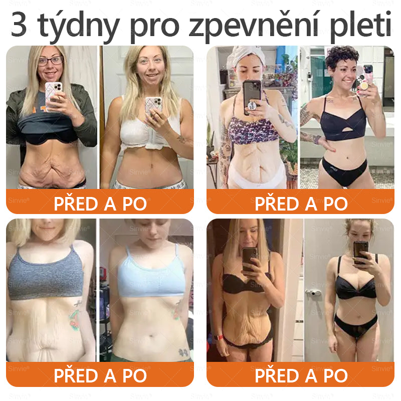 🎁🎁 Zůstává už jen 5 krabiček! Nabízíme vám dodatečnou slevu 50 %! Získejte zpět svou kondici a zdraví. Zhubněte teď a další šanci budete mít až příští rok.