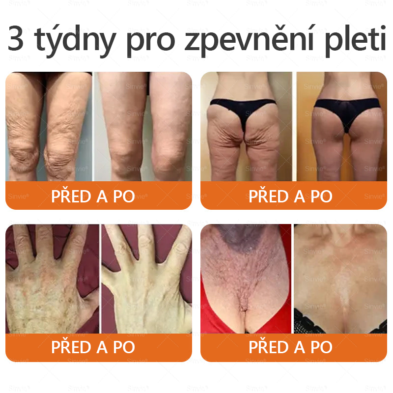 🎁🎁 Zůstává už jen 5 krabiček! Nabízíme vám dodatečnou slevu 50 %! Získejte zpět svou kondici a zdraví. Zhubněte teď a další šanci budete mít až příští rok.