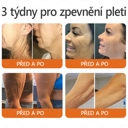 🎁🎁 Zůstává už jen 5 krabiček! Nabízíme vám dodatečnou slevu 50 %! Získejte zpět svou kondici a zdraví. Zhubněte teď a další šanci budete mít až příští rok.