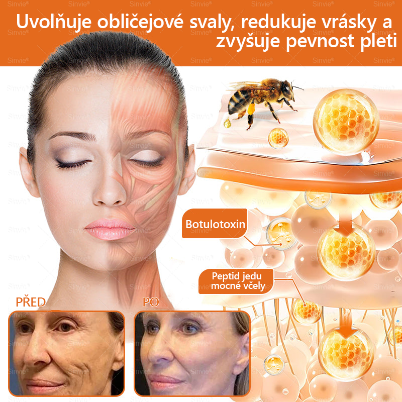👨‍⚕‍🐝 Sinvie® Krém na obnovu pleti s včelím jedem(👨‍⚕‍CE schváleno)👍✅