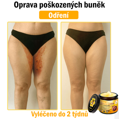 👨‍⚕‍🐝 Sinvie® Krém na obnovu pleti s včelím jedem(👨‍⚕‍CE schváleno)👍✅