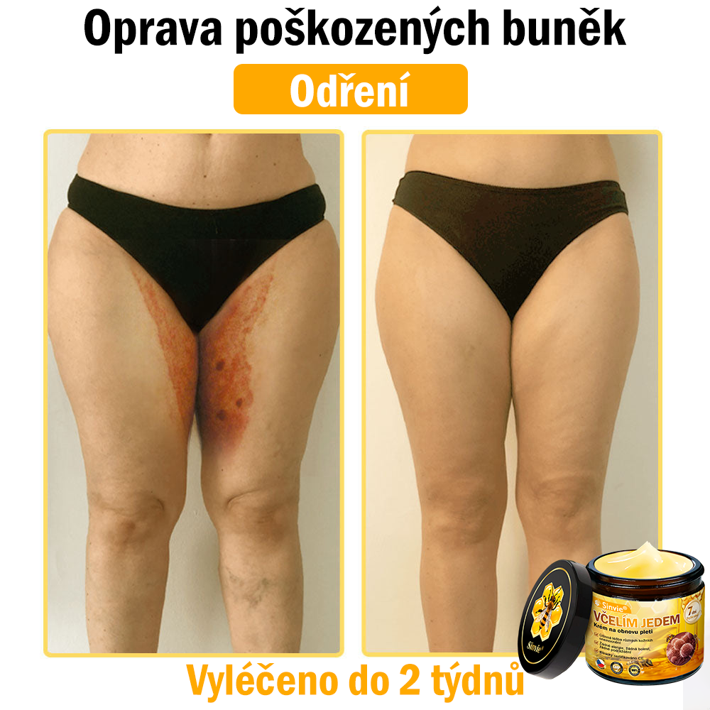 🐝 Sinvie® Krém na obnovu pleti s včelím jedem(👨‍⚕‍Výroba probíhá v souladu s normami GMP)👍✅