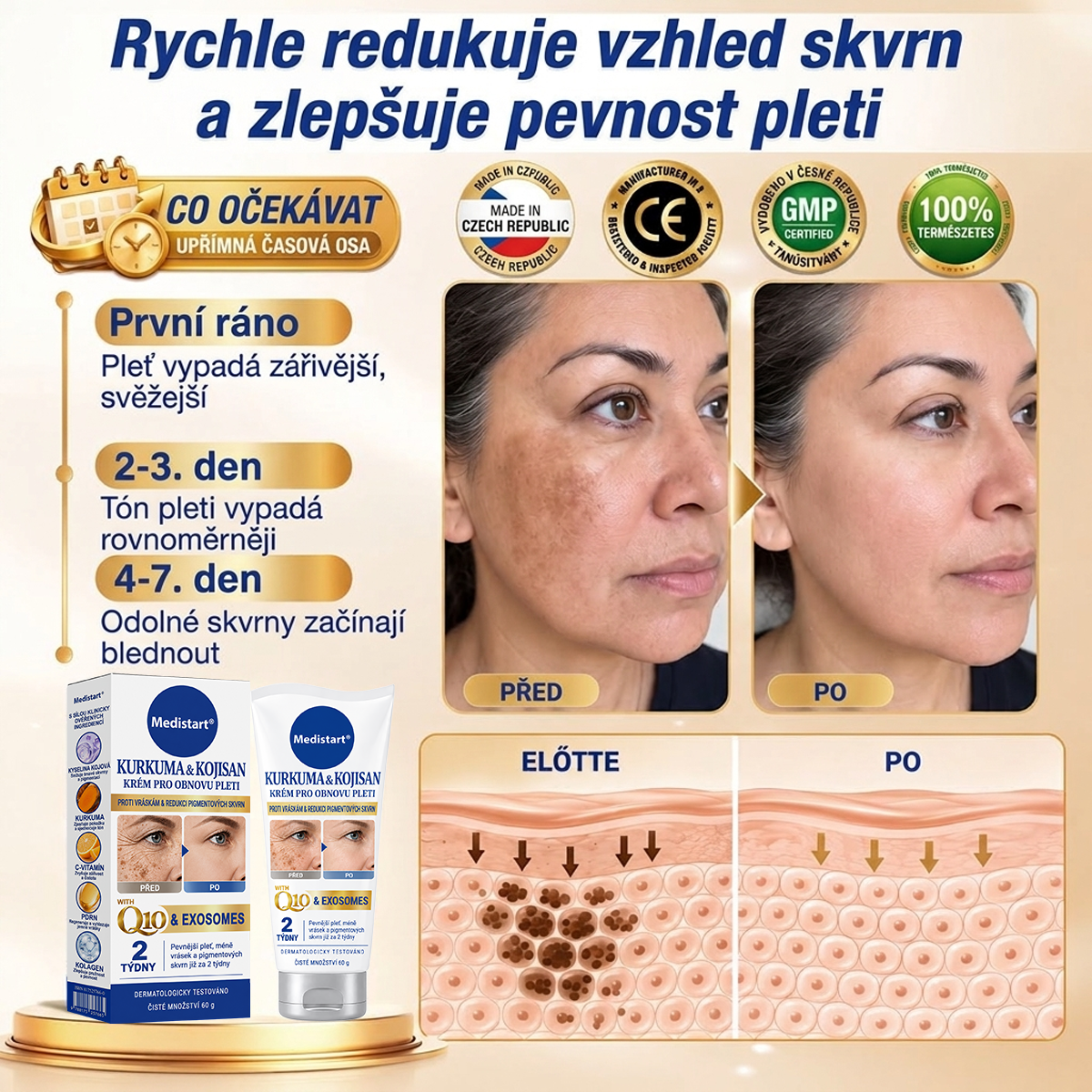 🧑‍⚕️ Medistart® 𝐊𝐮𝐫𝐤𝐮𝐦𝐚 × 𝐊𝐲𝐬𝐞𝐥𝐢𝐧𝐚 𝐤𝐨𝐣𝐨𝐯𝐚́ 𝐍𝐨𝐜̌𝐧𝐢́ 𝐨𝐦𝐥𝐚𝐳𝐮𝐣𝐢́𝐜𝐢́ 𝐤𝐫𝐞́𝐦 — 𝐙𝐞𝐬𝐯𝐞̌𝐭𝐥𝐢 𝐨𝐝𝐨𝐥𝐧𝐞́ 𝐭𝐦𝐚𝐯𝐞́ 𝐬𝐤𝐯𝐫𝐧𝐲 𝐚 𝐯𝐲𝐡𝐥𝐚𝐝̌ 𝐯𝐢𝐝𝐢𝐭𝐞𝐥𝐧𝐞́ 𝐯𝐫𝐚́𝐬𝐤𝐲 𝐛𝐞̌𝐡𝐞𝐦 𝐬𝐩𝐚́𝐧𝐤𝐮 🌙 ✅ 𝐉𝐞𝐝𝐞𝐧 𝐤𝐫𝐨𝐤 𝐤𝐚𝐳̌𝐝𝐨𝐮 𝐧𝐨𝐜 · 𝐕𝐢𝐝𝐢𝐭𝐞𝐥𝐧𝐚́ 𝐳𝐦𝐞̌𝐧𝐚 𝐳𝐚 𝟕 𝐧𝐨𝐜𝐢́ 💯