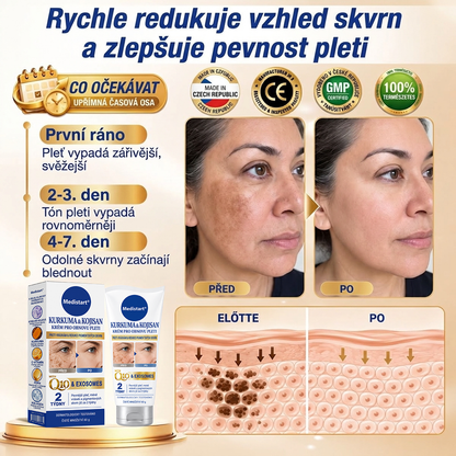 🧑‍⚕️ Medistart® 𝐊𝐮𝐫𝐤𝐮𝐦𝐚 × 𝐊𝐲𝐬𝐞𝐥𝐢𝐧𝐚 𝐤𝐨𝐣𝐨𝐯𝐚́ 𝐍𝐨𝐜̌𝐧𝐢́ 𝐨𝐦𝐥𝐚𝐳𝐮𝐣𝐢́𝐜𝐢́ 𝐤𝐫𝐞́𝐦 — 𝐙𝐞𝐬𝐯𝐞̌𝐭𝐥𝐢 𝐨𝐝𝐨𝐥𝐧𝐞́ 𝐭𝐦𝐚𝐯𝐞́ 𝐬𝐤𝐯𝐫𝐧𝐲 𝐚 𝐯𝐲𝐡𝐥𝐚𝐝̌ 𝐯𝐢𝐝𝐢𝐭𝐞𝐥𝐧𝐞́ 𝐯𝐫𝐚́𝐬𝐤𝐲 𝐛𝐞̌𝐡𝐞𝐦 𝐬𝐩𝐚́𝐧𝐤𝐮 🌙 ✅ 𝐉𝐞𝐝𝐞𝐧 𝐤𝐫𝐨𝐤 𝐤𝐚𝐳̌𝐝𝐨𝐮 𝐧𝐨𝐜 · 𝐕𝐢𝐝𝐢𝐭𝐞𝐥𝐧𝐚́ 𝐳𝐦𝐞̌𝐧𝐚 𝐳𝐚 𝟕 𝐧𝐨𝐜𝐢́ 💯