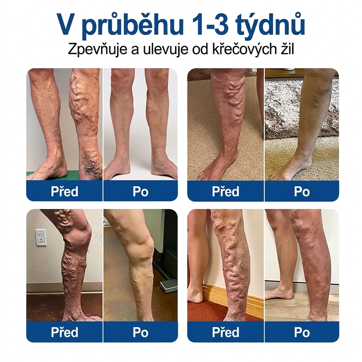 🧑‍⚕️🧑‍⚕️Medistart® VeinRepair mikrojehličková pečující náplast ⚡ Okamžitá úleva, dlouhodobé výsledky