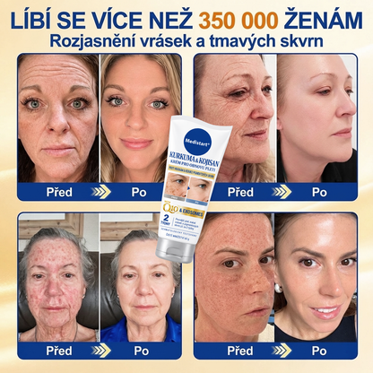 🧑‍⚕️ Medistart® 𝐊𝐮𝐫𝐤𝐮𝐦𝐚 × 𝐊𝐲𝐬𝐞𝐥𝐢𝐧𝐚 𝐤𝐨𝐣𝐨𝐯𝐚́ 𝐍𝐨𝐜̌𝐧𝐢́ 𝐨𝐦𝐥𝐚𝐳𝐮𝐣𝐢́𝐜𝐢́ 𝐤𝐫𝐞́𝐦 — 𝐙𝐞𝐬𝐯𝐞̌𝐭𝐥𝐢 𝐨𝐝𝐨𝐥𝐧𝐞́ 𝐭𝐦𝐚𝐯𝐞́ 𝐬𝐤𝐯𝐫𝐧𝐲 𝐚 𝐯𝐲𝐡𝐥𝐚𝐝̌ 𝐯𝐢𝐝𝐢𝐭𝐞𝐥𝐧𝐞́ 𝐯𝐫𝐚́𝐬𝐤𝐲 𝐛𝐞̌𝐡𝐞𝐦 𝐬𝐩𝐚́𝐧𝐤𝐮 🌙 ✅ 𝐉𝐞𝐝𝐞𝐧 𝐤𝐫𝐨𝐤 𝐤𝐚𝐳̌𝐝𝐨𝐮 𝐧𝐨𝐜 · 𝐕𝐢𝐝𝐢𝐭𝐞𝐥𝐧𝐚́ 𝐳𝐦𝐞̌𝐧𝐚 𝐳𝐚 𝟕 𝐧𝐨𝐜𝐢́ 💯