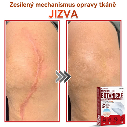 ✨PuraCure® Mikrojehličková botanická náplast na odstranění bradavic(✅CE certifikace)👍