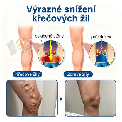 🧑‍⚕️🧑‍⚕️Medistart® VeinRepair mikrojehličková pečující náplast ⚡ Okamžitá úleva, dlouhodobé výsledky