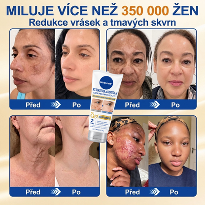 🧑‍⚕️ Medistart® 𝐊𝐮𝐫𝐤𝐮𝐦𝐚 × 𝐊𝐲𝐬𝐞𝐥𝐢𝐧𝐚 𝐤𝐨𝐣𝐨𝐯𝐚́ 𝐍𝐨𝐜̌𝐧𝐢́ 𝐨𝐦𝐥𝐚𝐳𝐮𝐣𝐢́𝐜𝐢́ 𝐤𝐫𝐞́𝐦 — 𝐙𝐞𝐬𝐯𝐞̌𝐭𝐥𝐢 𝐨𝐝𝐨𝐥𝐧𝐞́ 𝐭𝐦𝐚𝐯𝐞́ 𝐬𝐤𝐯𝐫𝐧𝐲 𝐚 𝐯𝐲𝐡𝐥𝐚𝐝̌ 𝐯𝐢𝐝𝐢𝐭𝐞𝐥𝐧𝐞́ 𝐯𝐫𝐚́𝐬𝐤𝐲 𝐛𝐞̌𝐡𝐞𝐦 𝐬𝐩𝐚́𝐧𝐤𝐮 🌙 ✅ 𝐉𝐞𝐝𝐞𝐧 𝐤𝐫𝐨𝐤 𝐤𝐚𝐳̌𝐝𝐨𝐮 𝐧𝐨𝐜 · 𝐕𝐢𝐝𝐢𝐭𝐞𝐥𝐧𝐚́ 𝐳𝐦𝐞̌𝐧𝐚 𝐳𝐚 𝟕 𝐧𝐨𝐜𝐢́ 💯