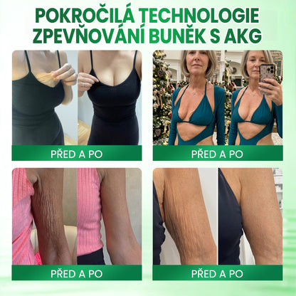 🧑‍⚕️Medistart® AKG ZPEVŇUJÍCÍ PÉČE O PLEŤ & PROTI STÁRNUTÍ
