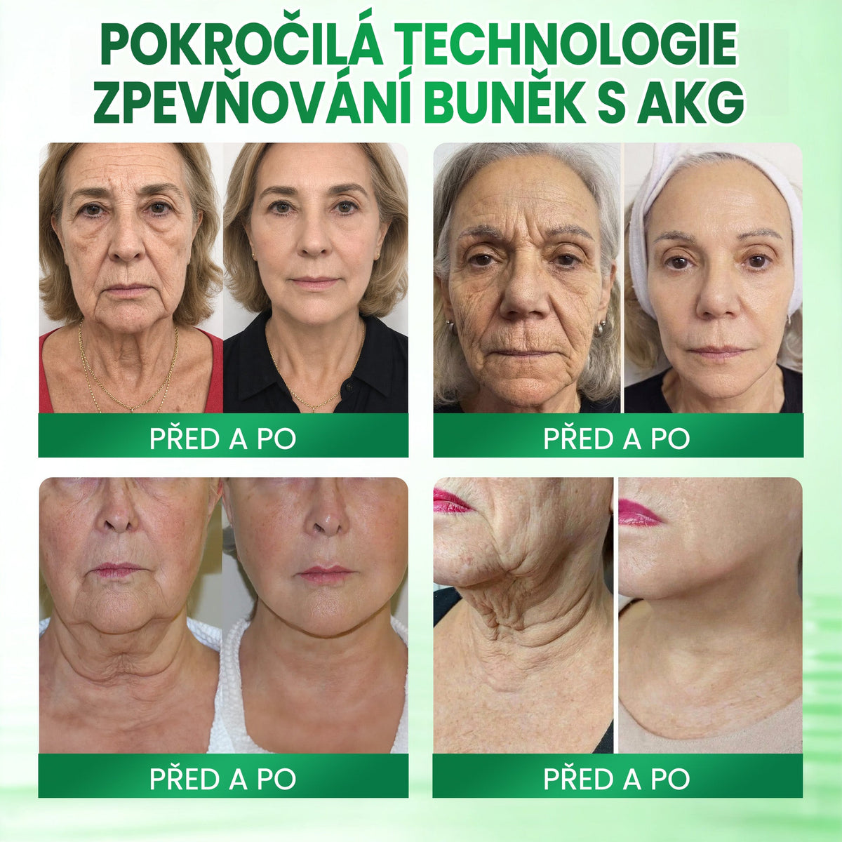 🧑‍⚕️Medistart® AKG ZPEVŇUJÍCÍ PÉČE O PLEŤ & PROTI STÁRNUTÍ