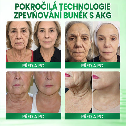 🧑‍⚕️Medistart® AKG ZPEVŇUJÍCÍ PÉČE O PLEŤ & PROTI STÁRNUTÍ