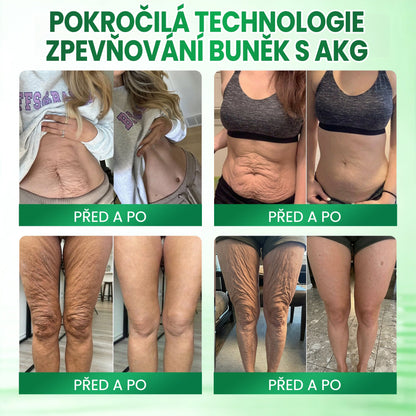 🧑‍⚕️Medistart® AKG ZPEVŇUJÍCÍ PÉČE O PLEŤ & PROTI STÁRNUTÍ