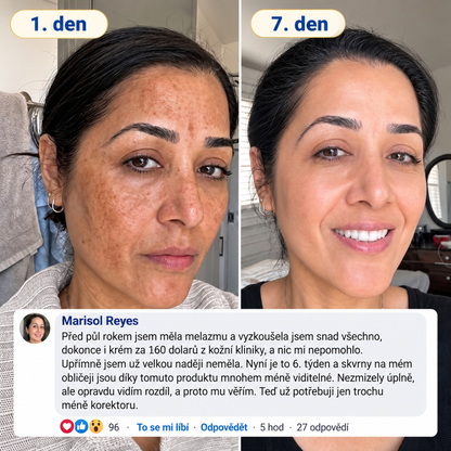 🧑‍⚕️ Medistart® 𝐊𝐮𝐫𝐤𝐮𝐦𝐚 × 𝐊𝐲𝐬𝐞𝐥𝐢𝐧𝐚 𝐤𝐨𝐣𝐨𝐯𝐚́ 𝐍𝐨𝐜̌𝐧𝐢́ 𝐨𝐦𝐥𝐚𝐳𝐮𝐣𝐢́𝐜𝐢́ 𝐤𝐫𝐞́𝐦 — 𝐙𝐞𝐬𝐯𝐞̌𝐭𝐥𝐢 𝐨𝐝𝐨𝐥𝐧𝐞́ 𝐭𝐦𝐚𝐯𝐞́ 𝐬𝐤𝐯𝐫𝐧𝐲 𝐚 𝐯𝐲𝐡𝐥𝐚𝐝̌ 𝐯𝐢𝐝𝐢𝐭𝐞𝐥𝐧𝐞́ 𝐯𝐫𝐚́𝐬𝐤𝐲 𝐛𝐞̌𝐡𝐞𝐦 𝐬𝐩𝐚́𝐧𝐤𝐮 🌙 ✅ 𝐉𝐞𝐝𝐞𝐧 𝐤𝐫𝐨𝐤 𝐤𝐚𝐳̌𝐝𝐨𝐮 𝐧𝐨𝐜 · 𝐕𝐢𝐝𝐢𝐭𝐞𝐥𝐧𝐚́ 𝐳𝐦𝐞̌𝐧𝐚 𝐳𝐚 𝟕 𝐧𝐨𝐜𝐢́ 💯