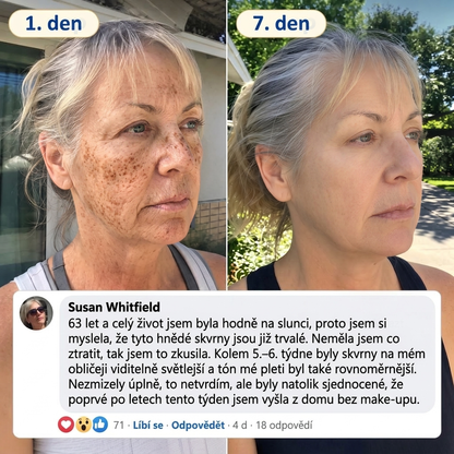 🧑‍⚕️ Medistart® 𝐊𝐮𝐫𝐤𝐮𝐦𝐚 × 𝐊𝐲𝐬𝐞𝐥𝐢𝐧𝐚 𝐤𝐨𝐣𝐨𝐯𝐚́ 𝐍𝐨𝐜̌𝐧𝐢́ 𝐨𝐦𝐥𝐚𝐳𝐮𝐣𝐢́𝐜𝐢́ 𝐤𝐫𝐞́𝐦 — 𝐙𝐞𝐬𝐯𝐞̌𝐭𝐥𝐢 𝐨𝐝𝐨𝐥𝐧𝐞́ 𝐭𝐦𝐚𝐯𝐞́ 𝐬𝐤𝐯𝐫𝐧𝐲 𝐚 𝐯𝐲𝐡𝐥𝐚𝐝̌ 𝐯𝐢𝐝𝐢𝐭𝐞𝐥𝐧𝐞́ 𝐯𝐫𝐚́𝐬𝐤𝐲 𝐛𝐞̌𝐡𝐞𝐦 𝐬𝐩𝐚́𝐧𝐤𝐮 🌙 ✅ 𝐉𝐞𝐝𝐞𝐧 𝐤𝐫𝐨𝐤 𝐤𝐚𝐳̌𝐝𝐨𝐮 𝐧𝐨𝐜 · 𝐕𝐢𝐝𝐢𝐭𝐞𝐥𝐧𝐚́ 𝐳𝐦𝐞̌𝐧𝐚 𝐳𝐚 𝟕 𝐧𝐨𝐜𝐢́ 💯