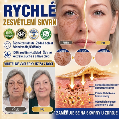 🧑‍⚕️ Medistart® 𝐊𝐮𝐫𝐤𝐮𝐦𝐚 × 𝐊𝐲𝐬𝐞𝐥𝐢𝐧𝐚 𝐤𝐨𝐣𝐨𝐯𝐚́ 𝐍𝐨𝐜̌𝐧𝐢́ 𝐨𝐦𝐥𝐚𝐳𝐮𝐣𝐢́𝐜𝐢́ 𝐤𝐫𝐞́𝐦 — 𝐙𝐞𝐬𝐯𝐞̌𝐭𝐥𝐢 𝐨𝐝𝐨𝐥𝐧𝐞́ 𝐭𝐦𝐚𝐯𝐞́ 𝐬𝐤𝐯𝐫𝐧𝐲 𝐚 𝐯𝐲𝐡𝐥𝐚𝐝̌ 𝐯𝐢𝐝𝐢𝐭𝐞𝐥𝐧𝐞́ 𝐯𝐫𝐚́𝐬𝐤𝐲 𝐛𝐞̌𝐡𝐞𝐦 𝐬𝐩𝐚́𝐧𝐤𝐮 🌙 ✅ 𝐉𝐞𝐝𝐞𝐧 𝐤𝐫𝐨𝐤 𝐤𝐚𝐳̌𝐝𝐨𝐮 𝐧𝐨𝐜 · 𝐕𝐢𝐝𝐢𝐭𝐞𝐥𝐧𝐚́ 𝐳𝐦𝐞̌𝐧𝐚 𝐳𝐚 𝟕 𝐧𝐨𝐜𝐢́ 💯