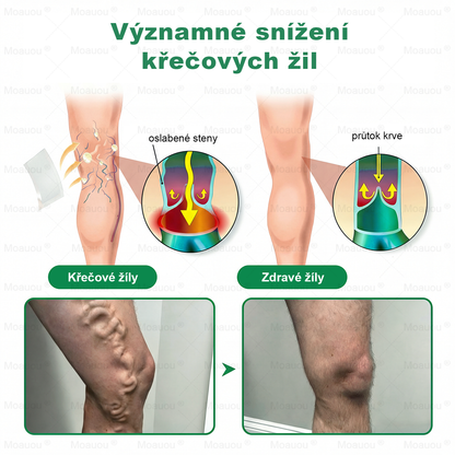 ✨✅Moauou® 𝐕𝐞𝐢𝐧 𝐓𝐚𝐫𝐠𝐞𝐭 𝐌𝐢𝐜𝐫𝐨𝐧𝐞𝐞𝐝𝐥𝐞 𝐏𝐚𝐭𝐜𝐡⚡Okamžitá úleva, dlouhodobé výsledky - Velký výprodej