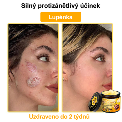 👨‍⚕‍🐝 Sinvie® Krém na obnovu pleti s včelím jedem(👨‍⚕‍CE schváleno)👍✅
