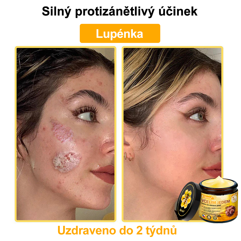 🐝 Sinvie® Krém na obnovu pleti s včelím jedem(👨‍⚕‍Výroba probíhá v souladu s normami GMP)👍✅