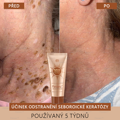 𝗣𝗮𝗿𝗼𝘄𝘂™ Bělící a Odstraňující Skvrny Maska – Přírodní složky trvale odstraňují pigmentové skvrny, stařecké skvrny, pihy a sluneční skvrny.