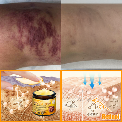 🔥🐝 Sinvie® Krém na obnovu pleti s včelím jedem(👨‍⚕‍CE certifikace)👍✅