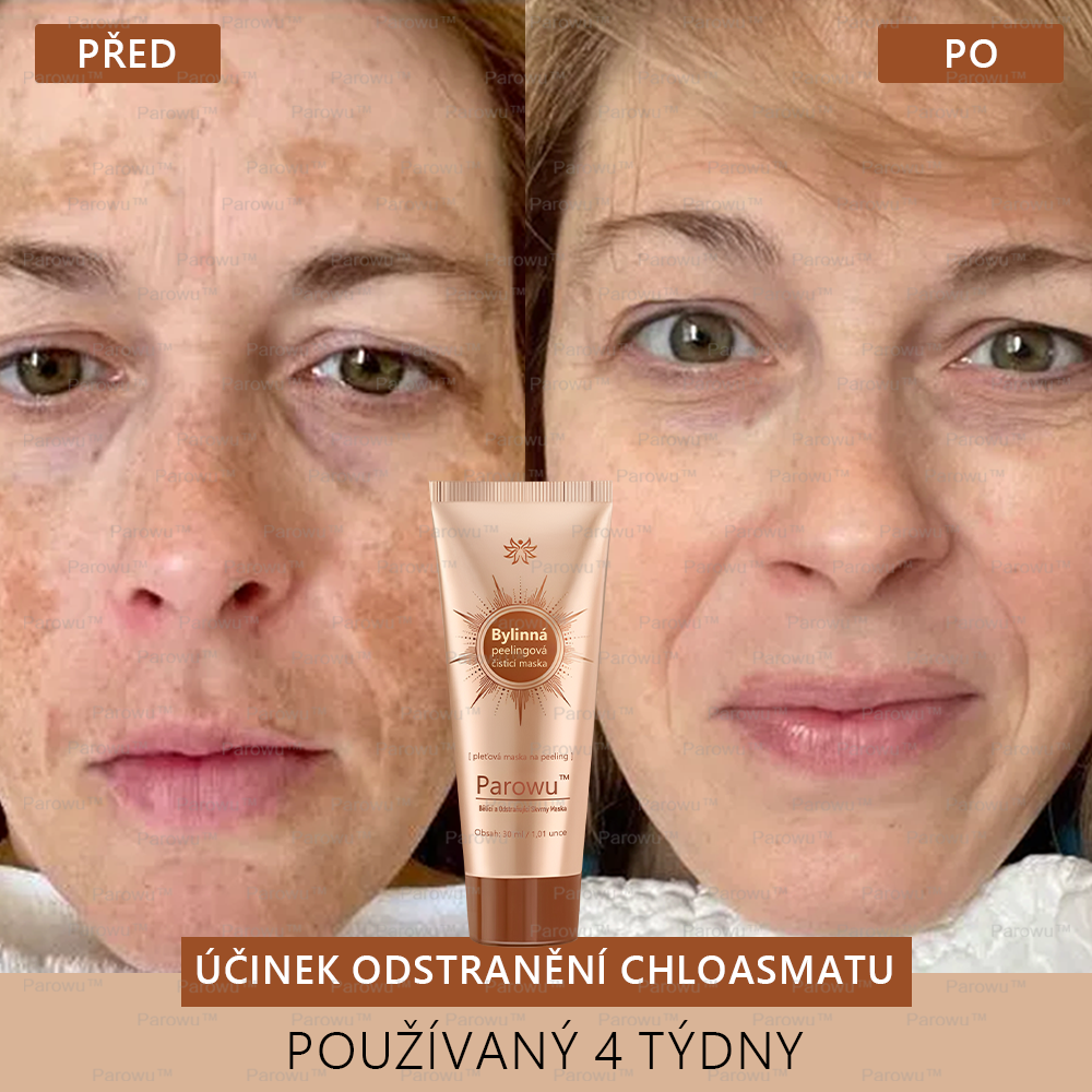 𝗣𝗮𝗿𝗼𝘄𝘂™ Bělící a Odstraňující Skvrny Maska – Přírodní složky trvale odstraňují pigmentové skvrny, stařecké skvrny, pihy a sluneční skvrny.